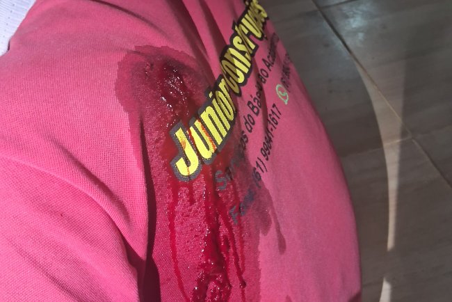 "AMOR E ÓDIO" Em  Formosa-Go, homem é esfaqueado  por companheira mas se nega a representar criminalmente contra ela .