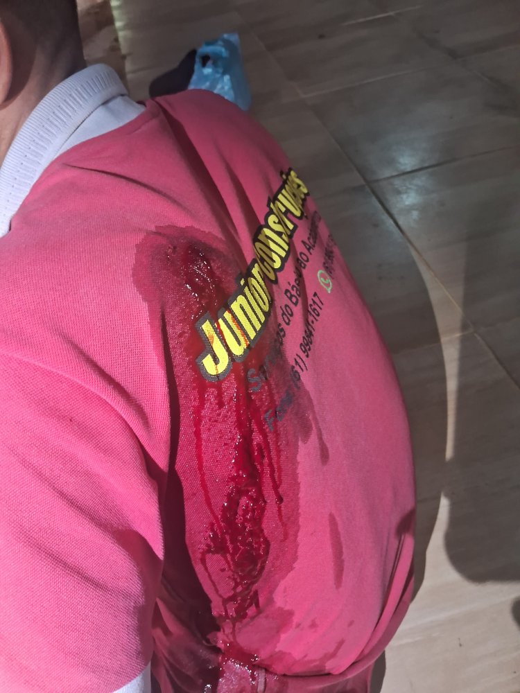 "AMOR E ÓDIO" Em  Formosa-Go, homem é esfaqueado  por companheira mas se nega a representar criminalmente contra ela .